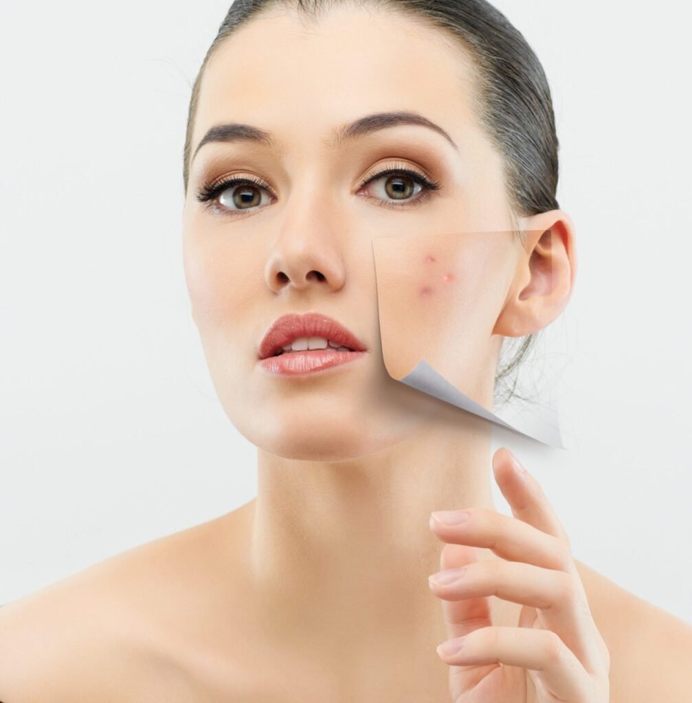 Dos and Don'ts of chemical peels