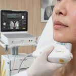Ultherapy Prime in Singapore: What’s Different and Is It Worth It?