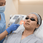 Acne Clear BBL: How BroadBand Light Therapy Finally Clears Stubborn Acne