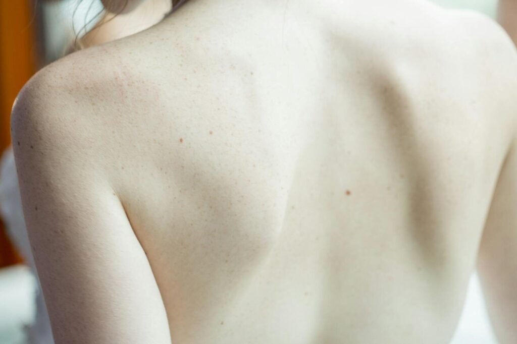 A detailed close-up image of a woman's back, highlighting skin texture and subtle freckles.